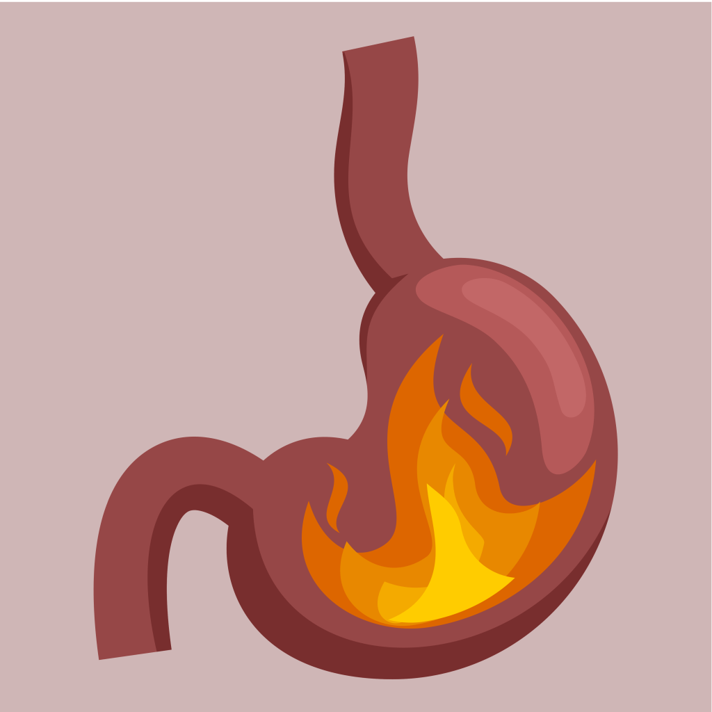 Acid Reflux & Heart&nbsp;Burn